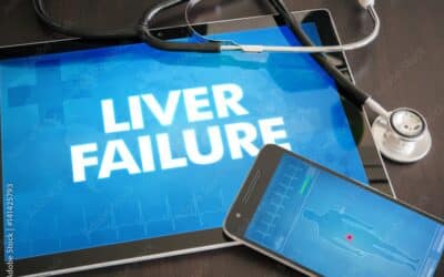 Leading Cause of Liver Failure in the US Revealed by NIH