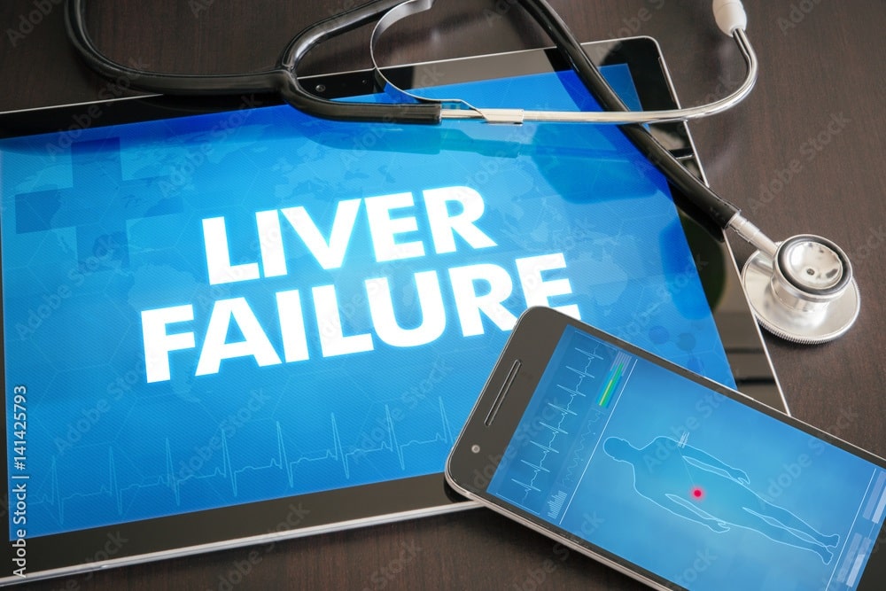 Leading Cause of Liver Failure in the US Revealed by NIH